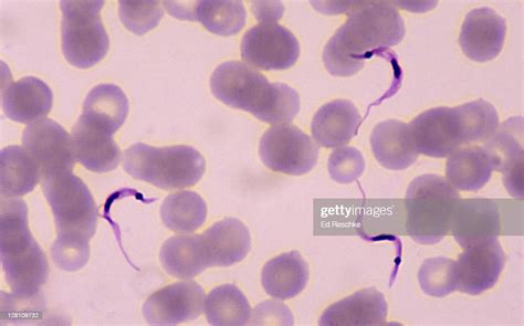  Trypanosoma: En mikroskopisk parasit som simmar med hjälp av en flagell och kan orsaka allvarliga sjukdomar!